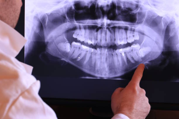 Best 24-Hour Emergency Dental Care in North Fort Lewis, WA