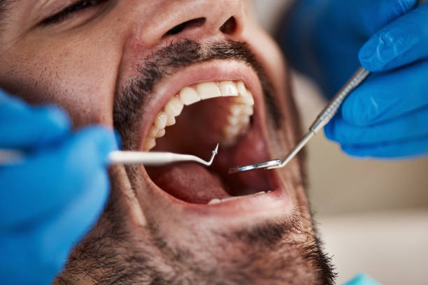 Best Urgent Dental Care for Toothaches in North Fort Lewis, WA